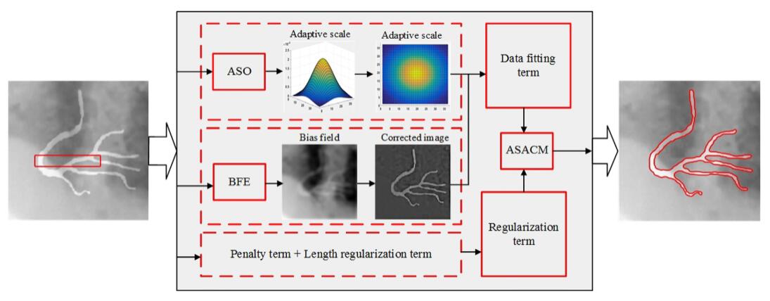 An Adaptive-Scale Active Contour Model for Inhomogeneous Image Segmentation and Bias Feld Estimation