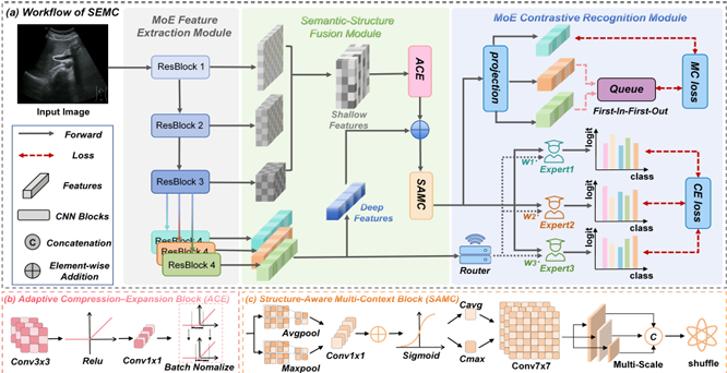 SEMC: Structure-Enhanced Mixture-of-Experts Contrastive Learning for Ultrasound Standard Plane Recognition